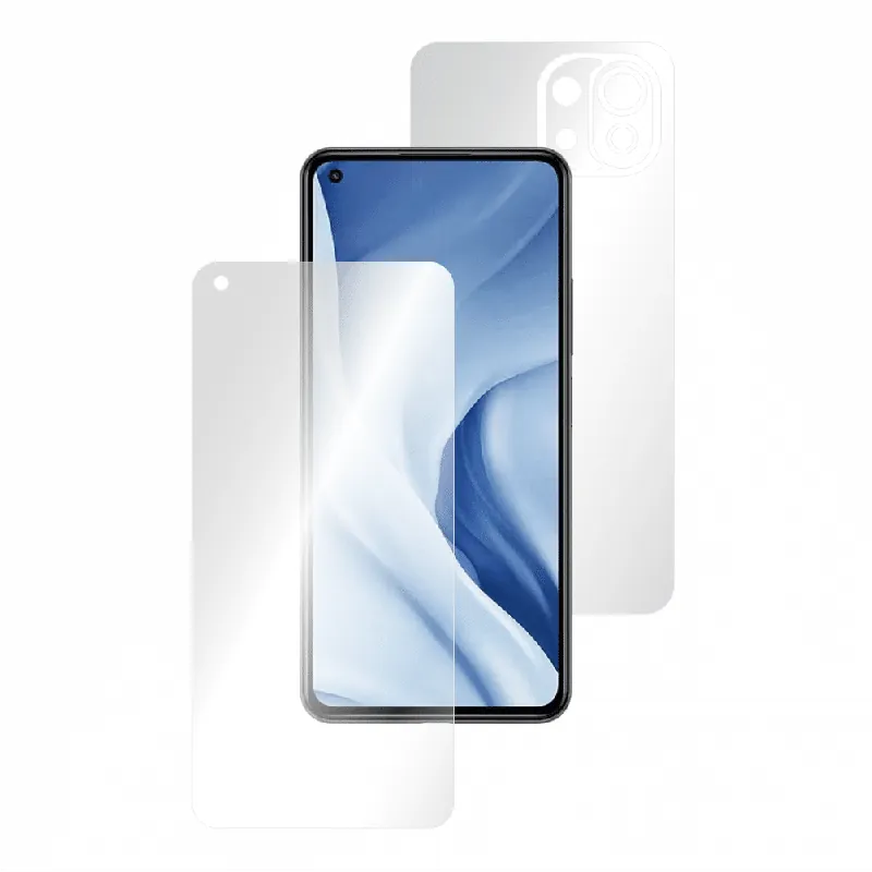 Premium Folie AntiReflex Mata Smart Protection Xiaomi Mi 11 Lite 5G